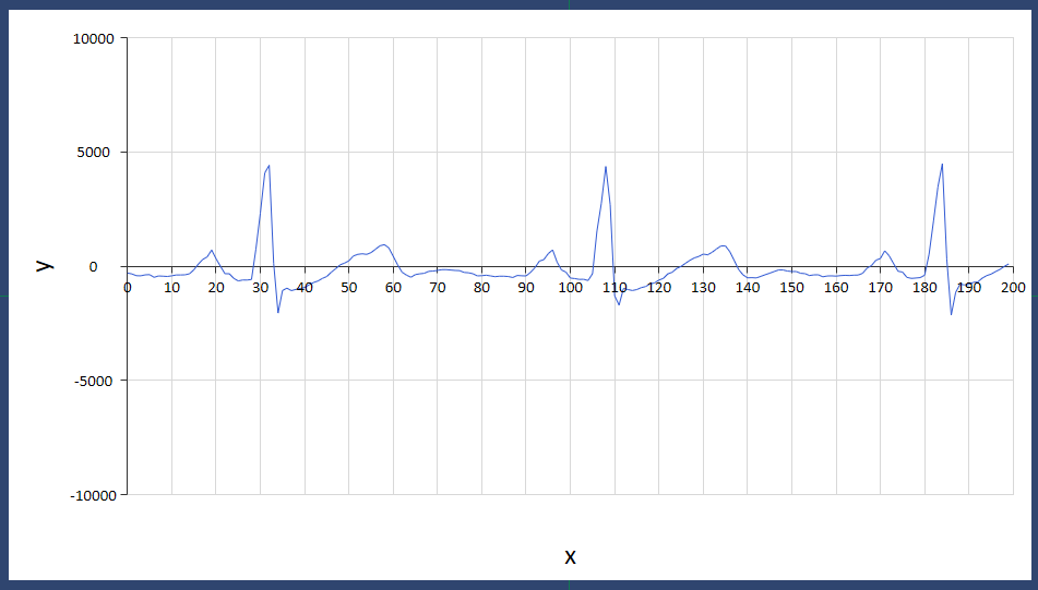 ecg_2_2021-08-04_19-11-24.png