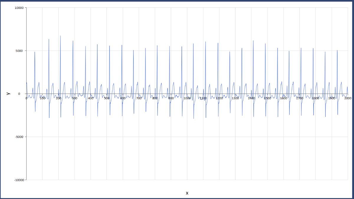 ecg_4_2021-08-04_20-03-15.png