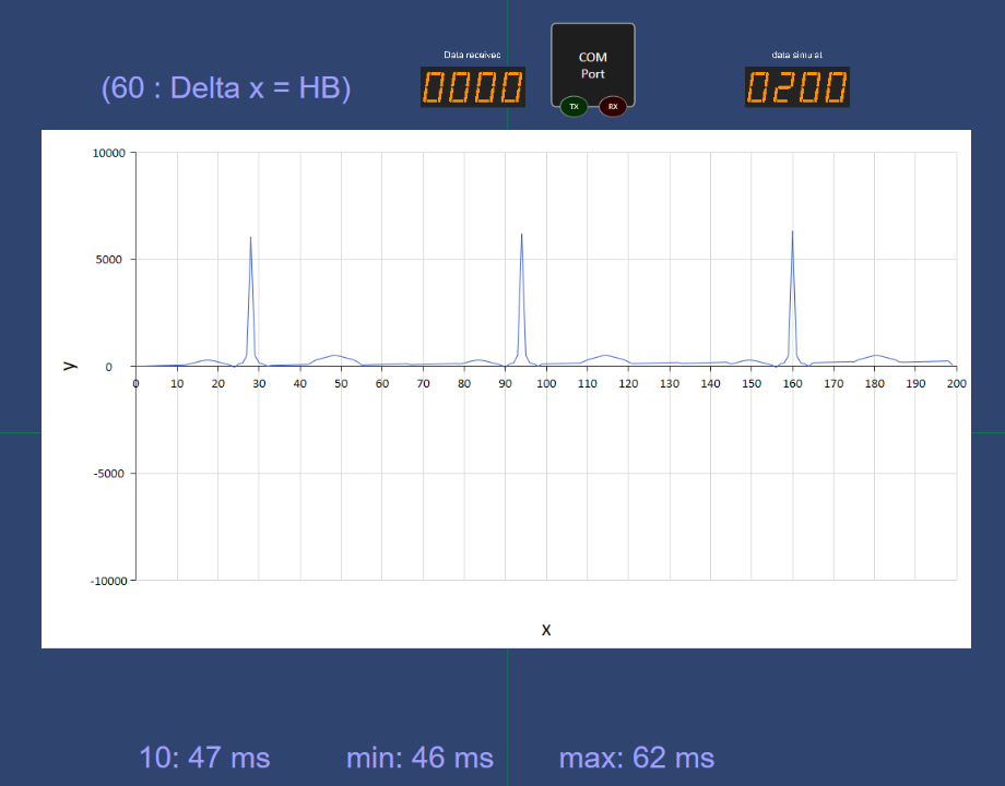 ecg_2021-08-06_11-33-30.png